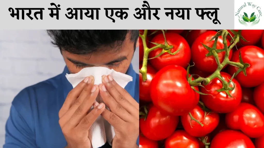 Tomato flu in India in Hindi