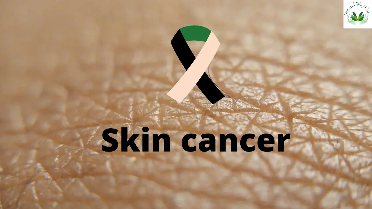 skin cancer in Hindi
