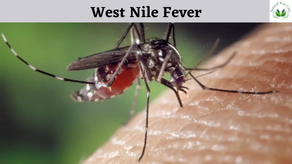 West Nile Fever in Hindi