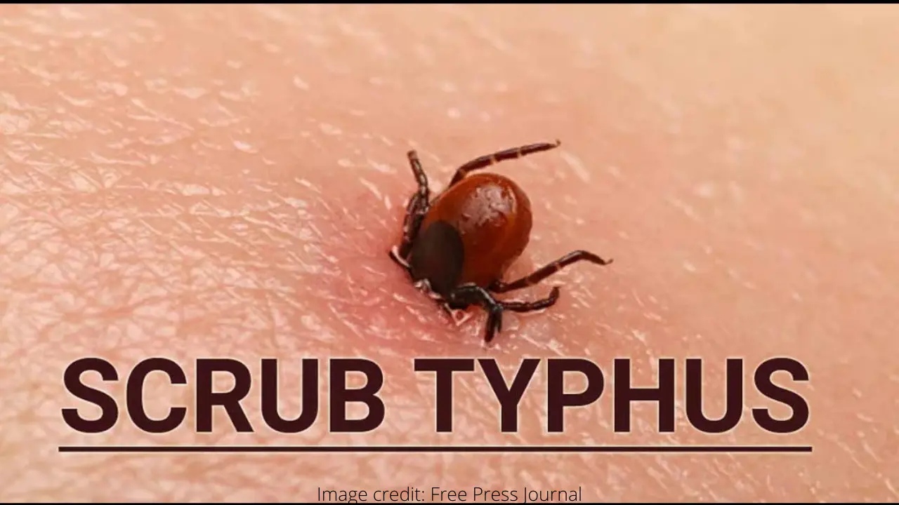 Scrub Typhus in hindi