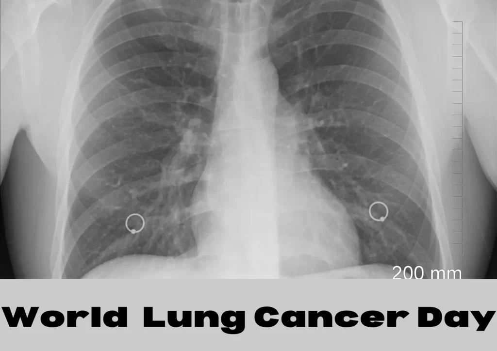 World lung cancer day in hindi