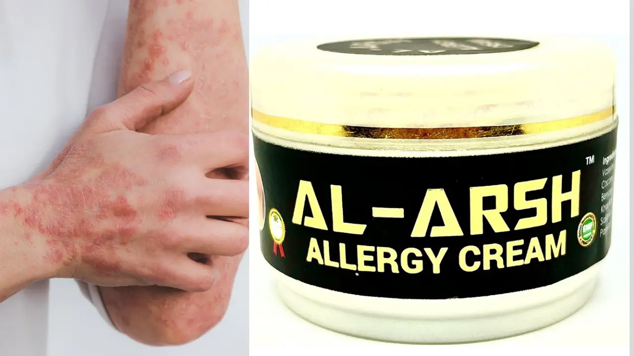 Al Arsh Allergy Cream review in hindi