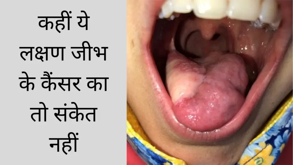 Symptoms of tongue cancer in hindi