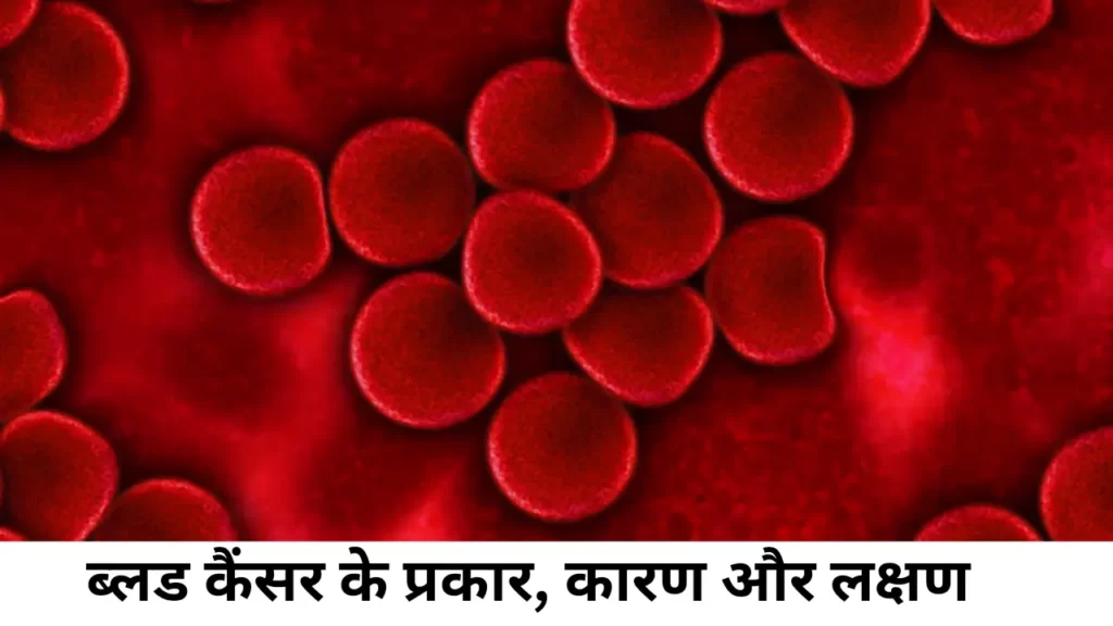Blood cancer kitne type ke hote hain karan aur lakshan in hindi