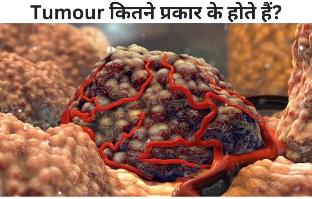 Tumour kitne prakar ke hote hain in hindi