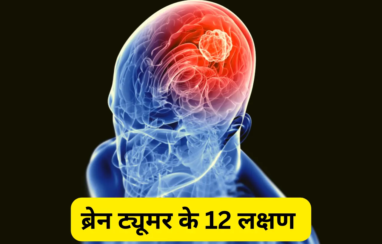 Brain tumour ke lakshan in hindi