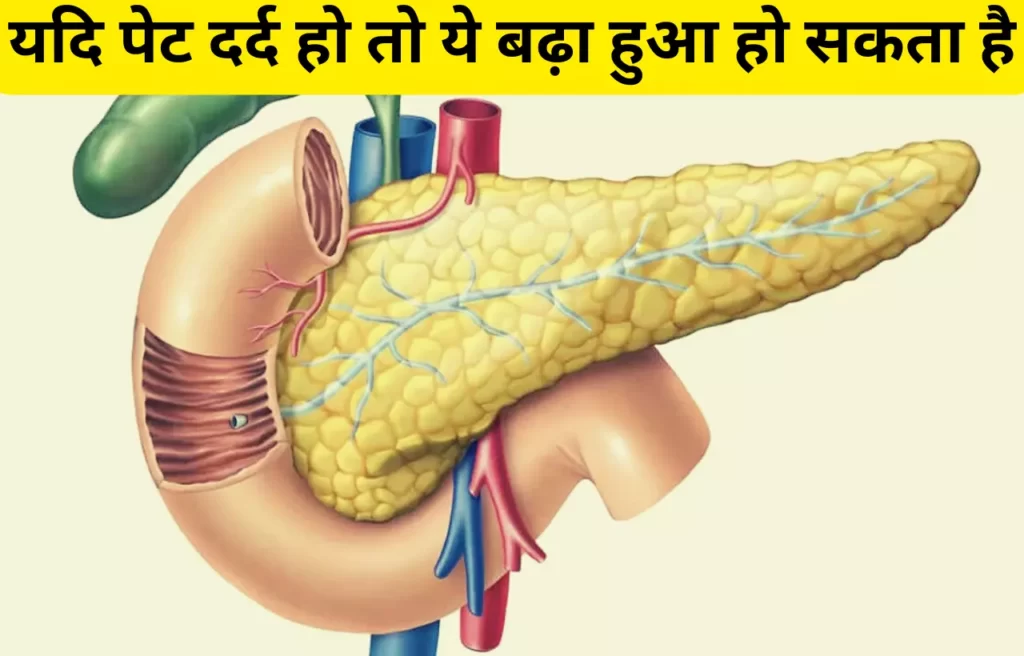 Pancreas me jujan ke lakshan in hindi