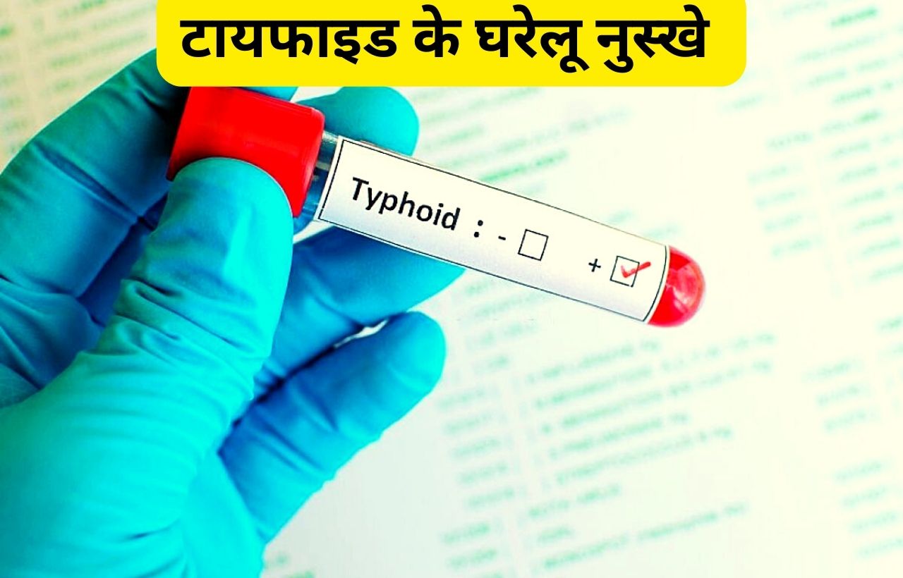 Typhoid ke gharelu upay nuskhe in hindi
