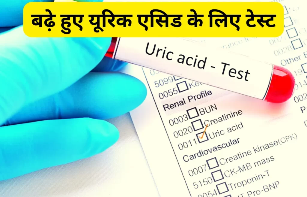 Uric acid ke liye test in hindi