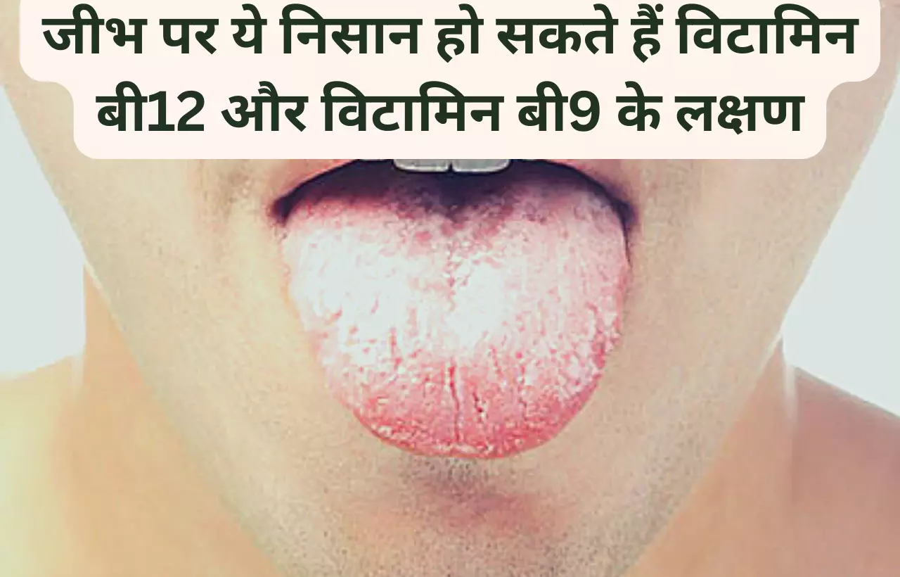 Vitamin b9 aur vitamin b12 ki kami ke lakshan in hindi