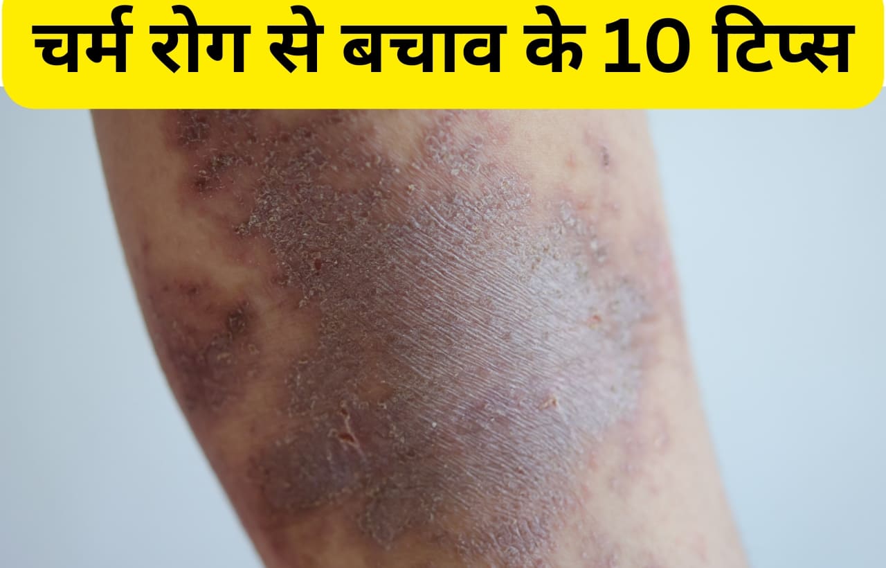 Skin disease prevention tips in hindi